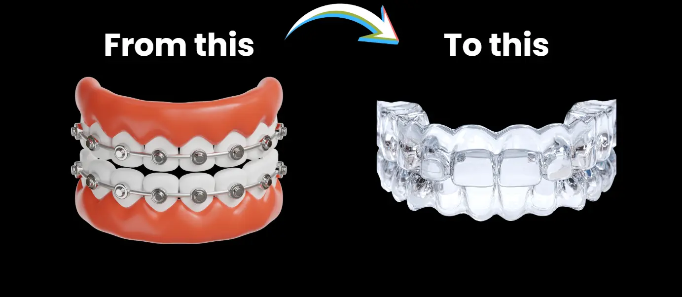 before and after Invisalign